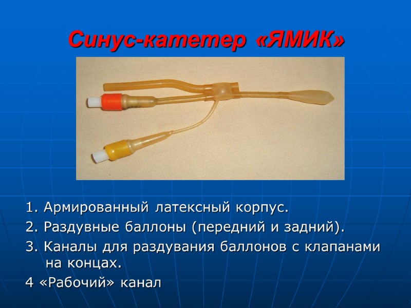 Синус-катетер «ЯМИК» 1. Армированный латексный корпус. 2. Раздувные баллоны (передний и задний). 3. Каналы